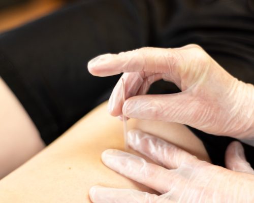 fernie-physiotherapy-FPT-024-85p-2000px