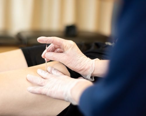 fernie-physiotherapy-FPT-025-85p-2000px